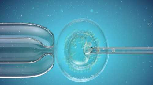 浙江正规的供卵机构 浙江试管婴儿费用 ‘胎囊线看男女’