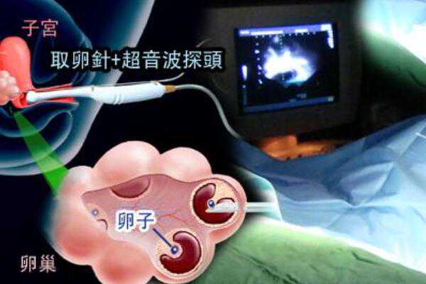 武汉代生生男孩怎么样 武汉同济医院的生殖医学中心 ‘怀孕12周nt看男女’