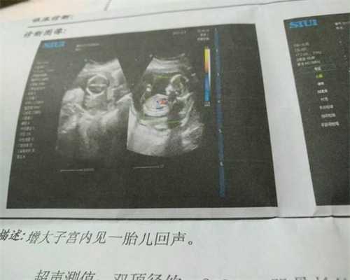 郑州服务哪家好试管婴儿_郑州试管找捐卵代码