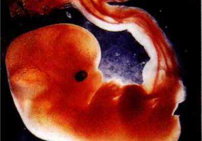 珠海医院供卵_输卵管积液去美国做试管婴儿，会影响胚胎着床吗？